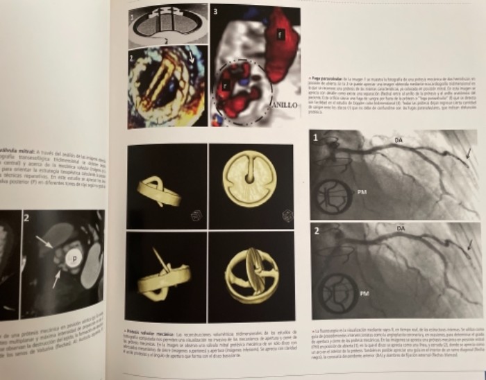 Imagen 2 del libro Atlas de imágenes de Cardiología