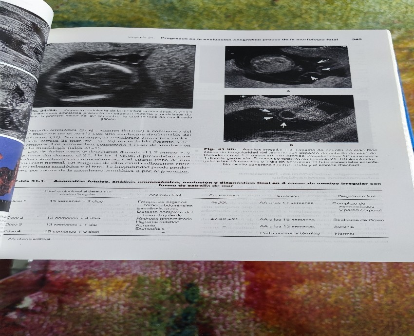 Imagen 2 del libro Ecografía en medicina materno - fetal